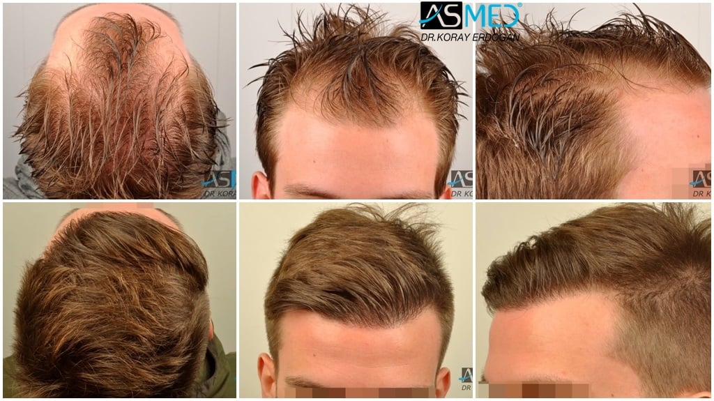Before & After Result