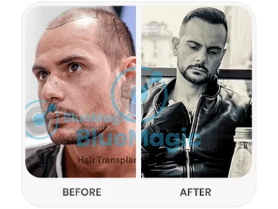 Before & After Result
