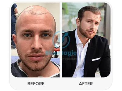 Before & After Result