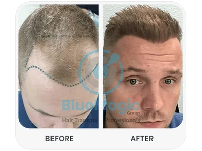 Before & After Result
