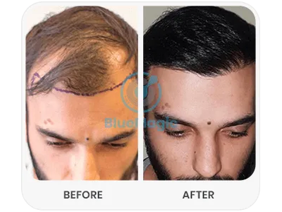Before & After Result