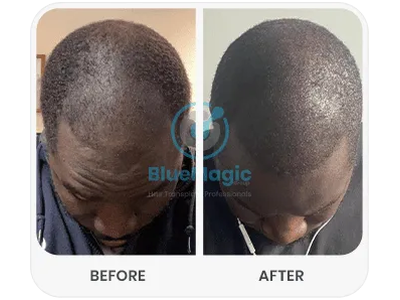 Before & After Result