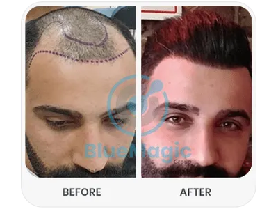 Before & After Result