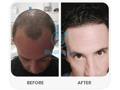 Before & After Result