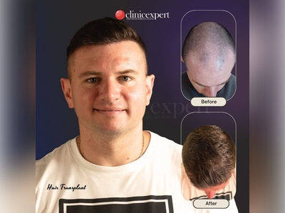 Before & After Result