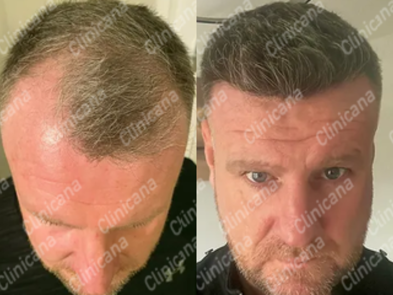 Before & After Result