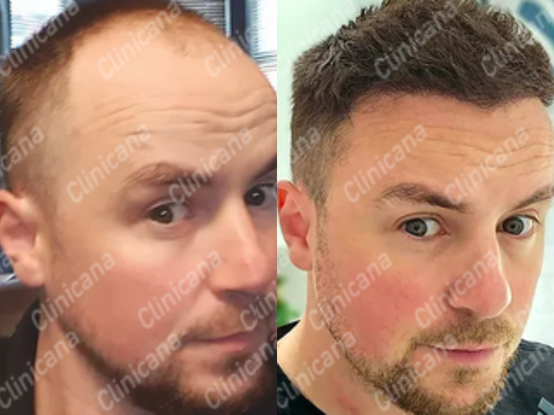 Before & After Result