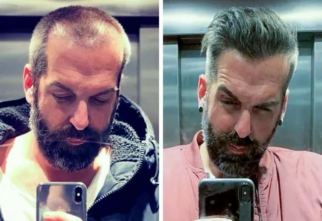 Before & After Result