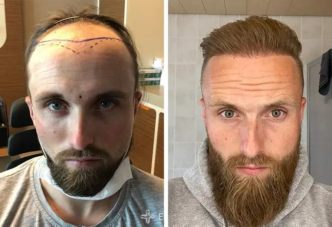 Before & After Result
