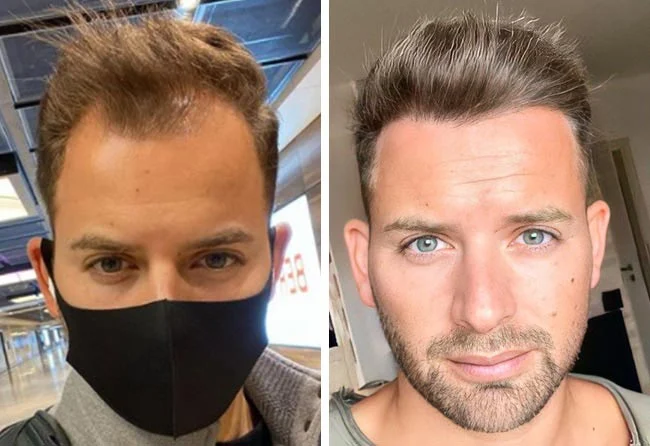 Before & After Result