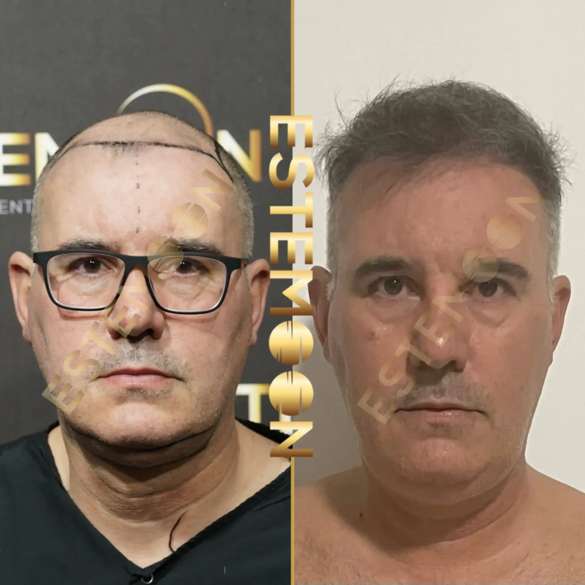 Before & After Result