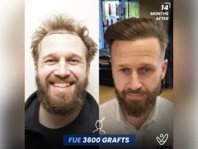 Before & After Result