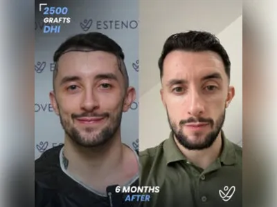 Before & After Result
