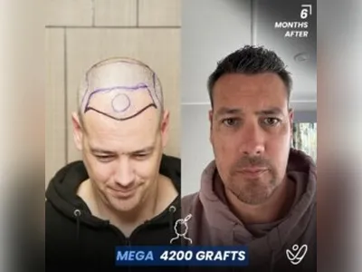 Before & After Result