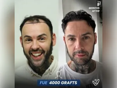 Before & After Result