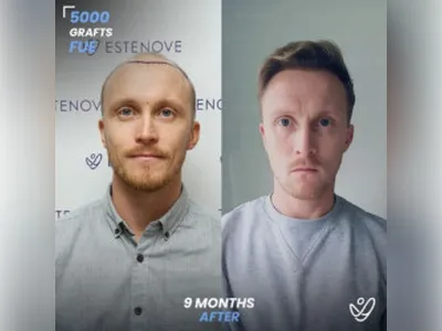 Before & After Result