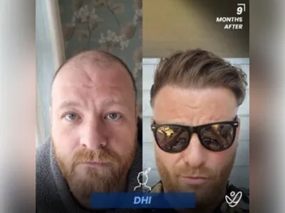 Before & After Result