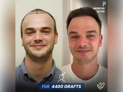 Before & After Result