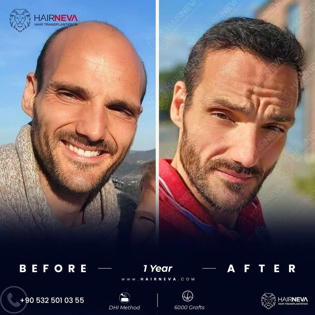 Before & After Result