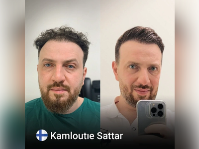 Before & After Result