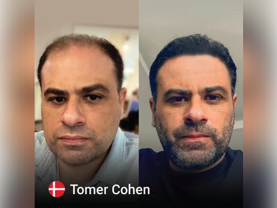 Before & After Result