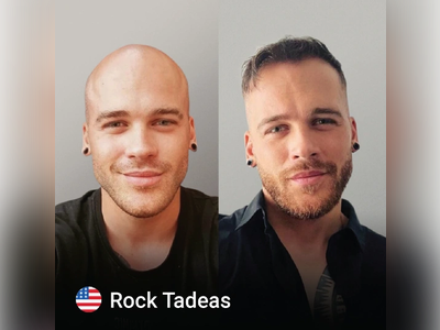 Before & After Result