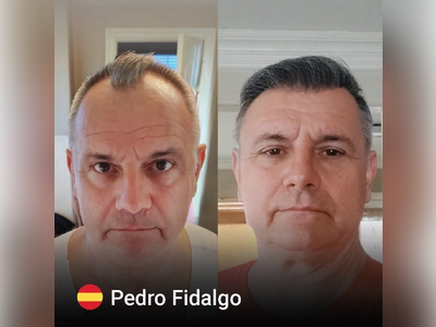Before & After Result