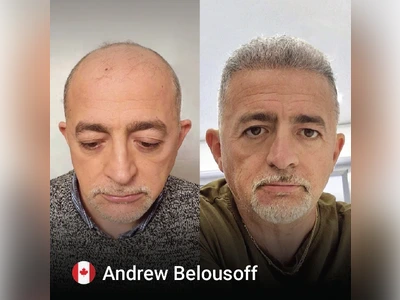 Before & After Result