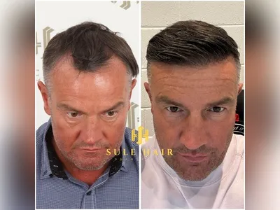 Before & After Result