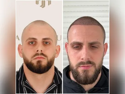 Before & After Result