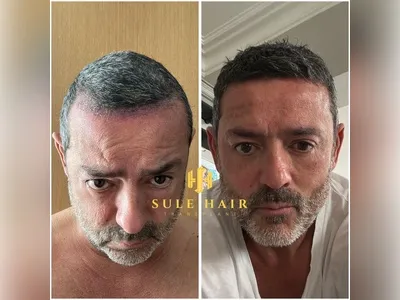 Before & After Result